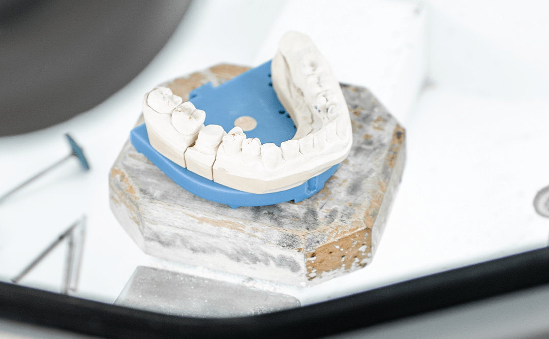 Las ventajas del Zirconio en las restauraciones dentales